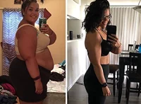 Vorher Ergebnis Anna